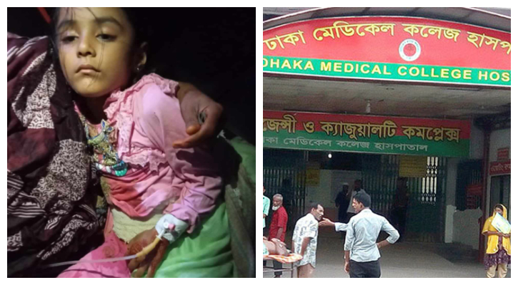 ঢামেকে সেই শিশুর অস্ত্রোপচার সম্পন্ন 