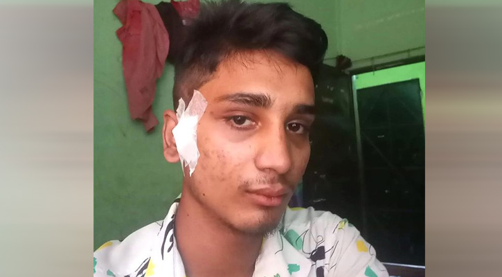 মাথায় গুলি নিয়ে সাড়ে ৮ মাস, অবশেষে মারা গেলেন জুলাইযোদ্ধা ‘হৃদয়’
