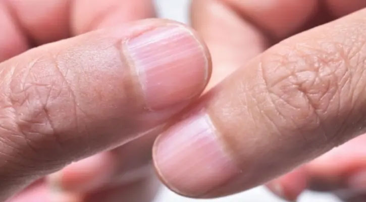 সুন্দর-পরিষ্কার ঝকঝকে নখ চান?