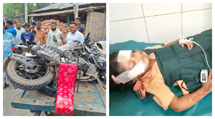 বাঘায় বাস চাপায় বাবা-মেয়ের পা বিচ্ছিন্ন