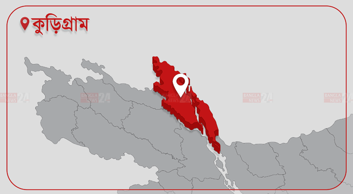 পল্লি চিকিৎসকের ভুল চিকিৎসায় ঝলসে গেছে শিশুর শরীর