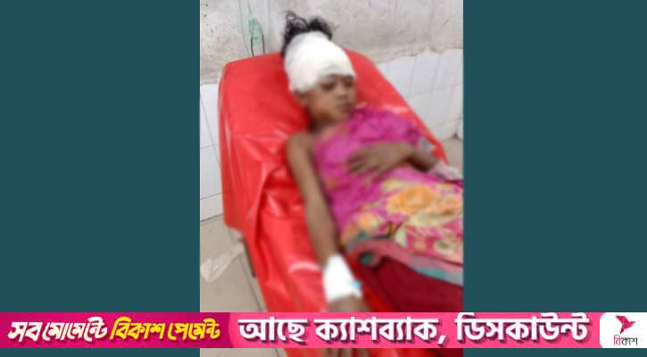 এক আনা স্বর্ণের দুলের লোভে শিশুকে হত্যাচেষ্টা!