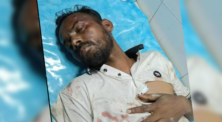 হামলার শিকার হিরো আলম, হাসপাতালে ভর্তি