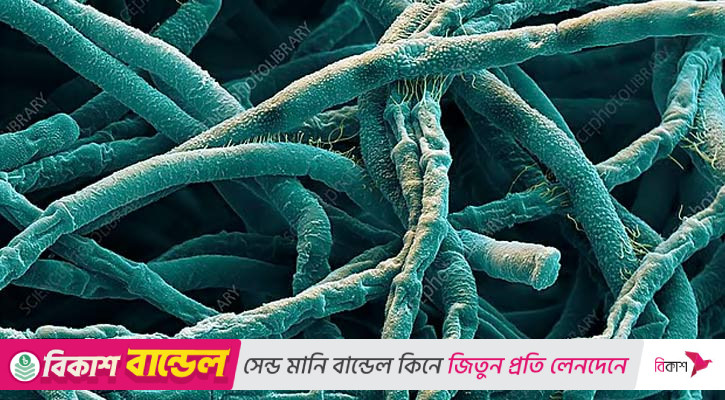 অ্যানথ্রাক্স প্রতিরোধে সমন্বিত কার্যক্রম শুরু