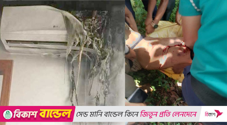 চমেক হাসপাতালে এসি বিস্ফোরণে ৩ জন দগ্ধ